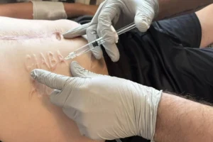 Лікарі допоможуть військовому позбутися зробленого росіянами страшного напису на тілі