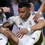 Розсічення не завада: Мбаппе очікують у матчі Ліги чемпіонів