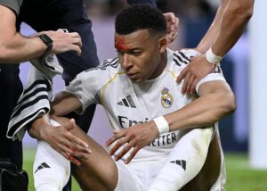 Розсічення не завада: Мбаппе очікують у матчі Ліги чемпіонів